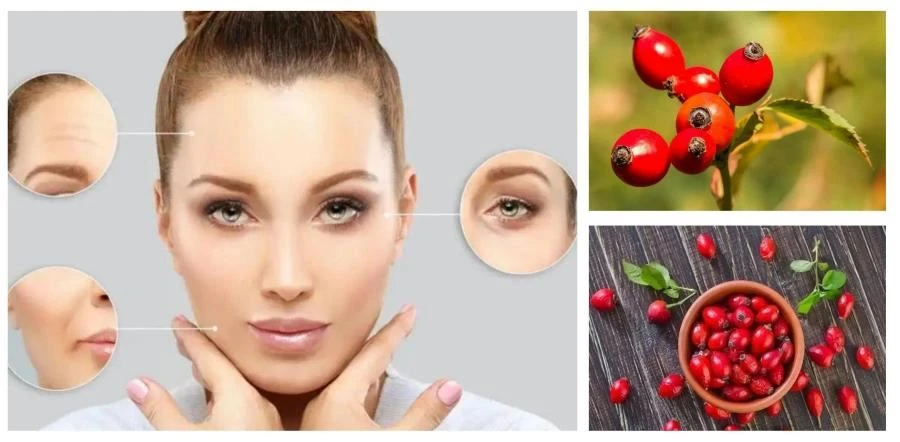 Rosa Canina Extract